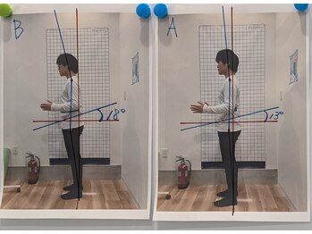 宮内整骨院 市川妙典院/姿勢チェック（施術前・後）