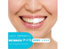 ホワイトニングジム アイス