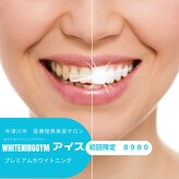 ホワイトニングジム アイス