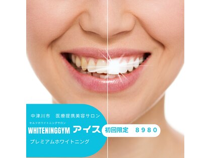 ホワイトニングジム アイスの写真