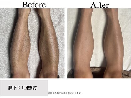 ザ アドア(The Adore)の写真