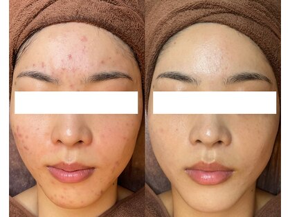 スイ(Suui.)の写真