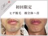 【初回限定】初回メンズひげ脱毛(顔全体～首まで)★通常5,500円→