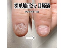 スマイルニコ(smile nico)の雰囲気（子供さんの爪の悩みもご相談ください。10歳以上なら施術OK！）