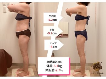 ラ コンシェル 町田店/Before After【町田店】