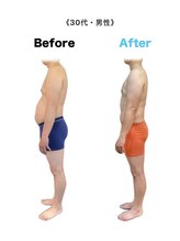 アンカーフィット(ANCHORFIT)/◆施術例◆ウエストの引き締め