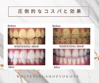 ホワイトニングショップ 横手店