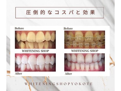 ホワイトニングショップ 横手店の写真
