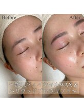 エレガ(ELEGA)/フェイシャルWAX+アイブロウ