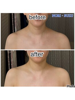 ノリスズ(NORI SUZU)/美しい肩は当サロンで作れます