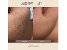 モアトゥインクル 東広島西条店(MORE twinkle)