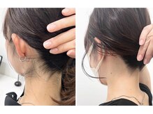 ミース 宮崎店/宮崎市で人気のうなじ脱毛サロン