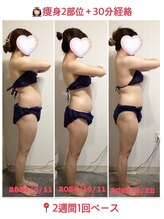 BEAUTYSALONカトレア獨協大学前店【3/5 NEW OPEN（予定）】/★そり腰改善★