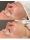 アイビーケア 三田(ivy care)の写真/【40代からの艶肌ピーリング】剥離なしの肌育ピーリングでほうれい線・シワ・たるみ・毛穴開きを集中ケア。