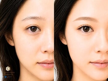 まつげ屋リュ( Ly)の写真/《全エクステLED施術◎》綺麗長持ち♪初めての方にも人気！モチ・ラクさ・仕上がり重視の信頼サロン☆