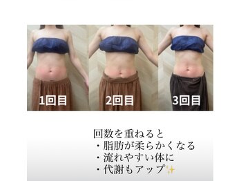 介正鍼灸整骨院 整体院 エフコープ大野城店/痩身エステ＊ビフォーアフター