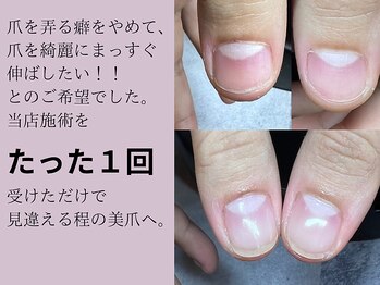 サロンエヌ(salon enu)/パラジェル深爪緩和クリアコース