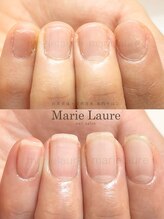 マリーロール 梅田店(Marie Laure)/深爪矯正/自爪育成/自爪風