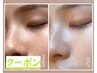 芸能人水光ピーリング回数券をご購入の方専用予約