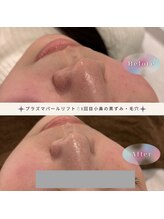 ディアー(Dear)/プラズマパールリフト