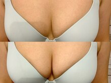 クラウン 心斎橋店(CROWN)/★バストケア★