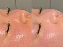 ルーナジェーナ(Luna llena)/