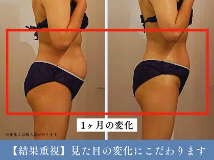 サンティエールの写真