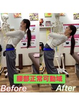 ヒデ整体院(Hide整体院)/猫背矯正骨盤矯正B/A肩こり腰痛
