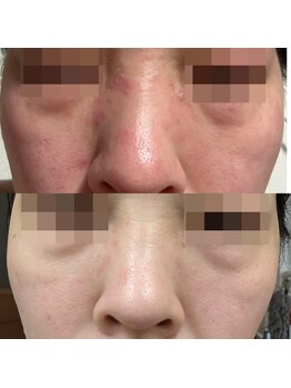 エステドブルー(Este de Bleu)/ビフォーアフター10/2から12/18