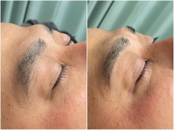 レフィナドール(Refinador)/眉毛ワックス 初回¥4,000