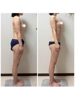 イッツソウ(It's so...)の写真/バストケアしながら全身引き締め!美脚くびれへ導く◎解剖学熟知のプロが全身上向きボディをサポート♪