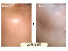 イーズサロン 西大寺店/ノーファンデ肌へ