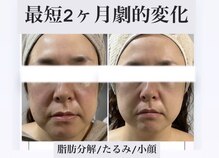 サロンドボーテ ベル(SALONDEBEAUTE BELLE)