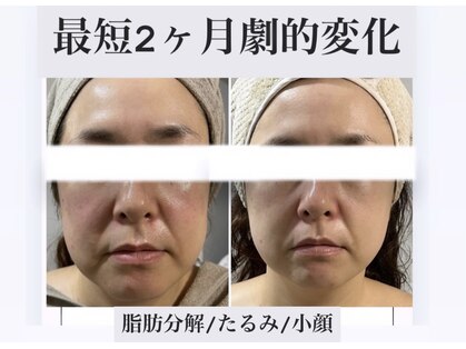 サロンドボーテ ベル(SALONDEBEAUTE BELLE)の写真