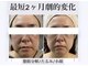 サロンドボーテ ベル(SALONDEBEAUTE BELLE)の写真