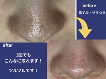 ベリル(BERYL)/1回でもこの結果！