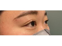 ラス 方南町駅前店(LATH)/３月★まつげ