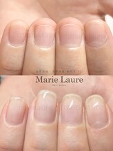 マリーロール 淀屋橋本店(Marie Laure)/自爪育成/深爪矯正/ネイルケア