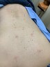 【手指の痛みカクカク動かすと痛いでお悩みの方】50分鍼灸整体¥6100⇒¥5500