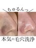【平日限定】毛穴洗浄＋炭酸パック＋高保湿パック＋ホームケア付☆ ¥12,300→