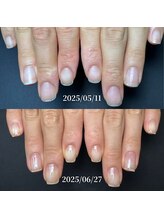 ココ(COCO)/ハンドケア・自爪育成・深爪育成