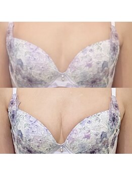 えすてさろん ケイアンドエフ(k&f)/【バストアップ】上向きバストへ