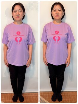 フジヤマ(FUJIYAMA)/施術後チェック～前