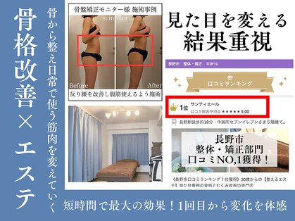 サンティエールの写真