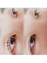 コア(Koa)/before　after