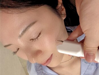 ピュアボディ(Pure Body)の写真/諦めていたシミを改善!【30分間シミケア放題コース★¥4980】圧倒的変化に自信◎気になる部分を思う存分♪