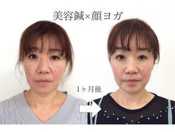 ユイユイマール(Yui Yui Maru)/自然の力でリフトアップ♪