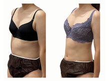 シャンス アルファ(chance)の雰囲気(一度の施術で効果実感!バスト悩みを解決しながらスリム効果も◎)