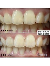 ビーバイビー(BBYB)/初回トライアルの実例♪