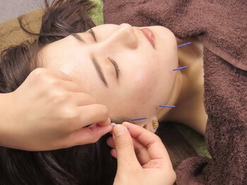 本多鍼灸整骨院/美容鍼